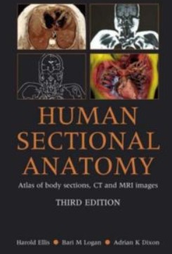 Download Human Sectional Anatomy 3rd Edition PDF Free