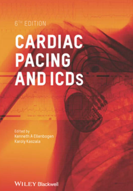 Download Cardiac Pacing and ICDs 6th Edition PDF Free