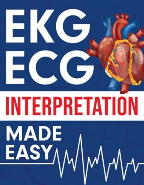 EKG | ECG Interpretation Made Easy 2022 PDF Free Download