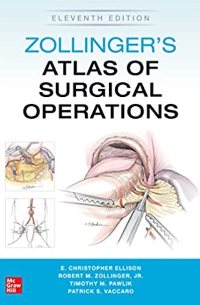 Zollinger’s Atlas of Surgical Operations 11th Edition New PDF Download